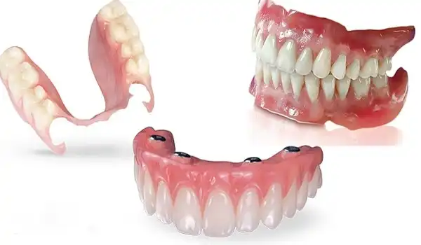 قیمت دندان مصنوعی آمریکایی
