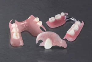 هزینه پروتز دندان تکی (پارسیل) 