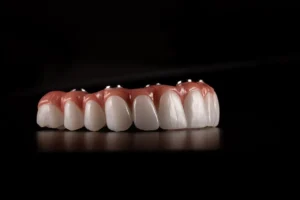 انواع دندان مصنوعی متحرک و ثابت
