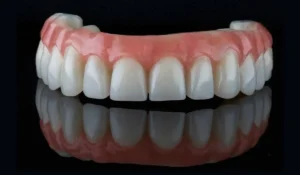 اجزای اصلی دندان مصنوعی
