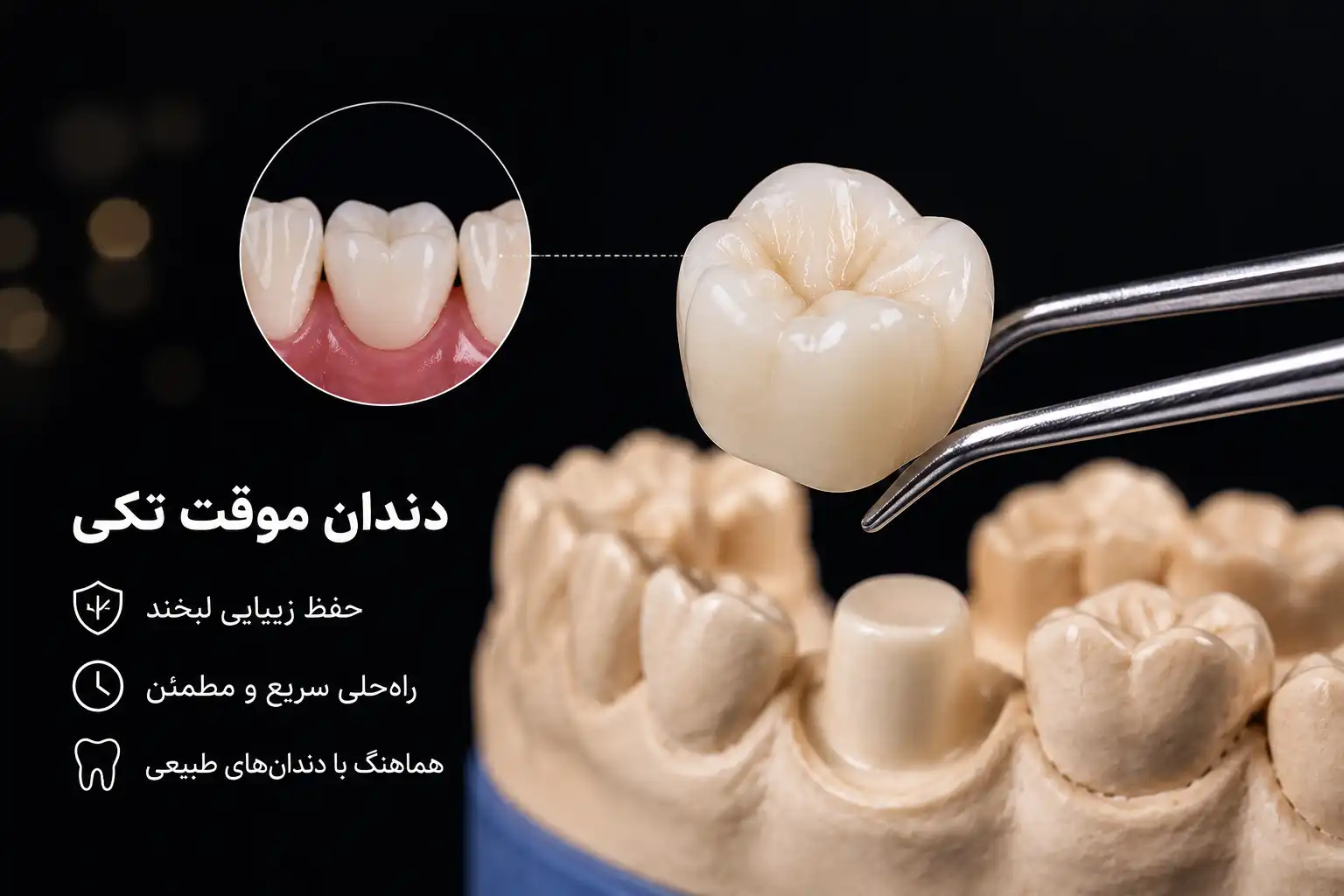 دندان موقت تکی